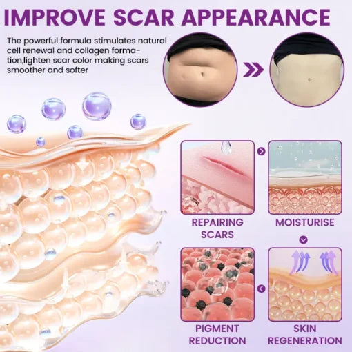TIMILK Advanced Scarvanisher Gel | Fast-Acting Scar & Stretch Mark Reduction | 30g