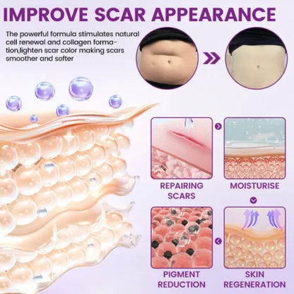 TIMILK Advanced Scarvanisher Gel | Fast-Acting Scar & Stretch Mark Reduction | 30g