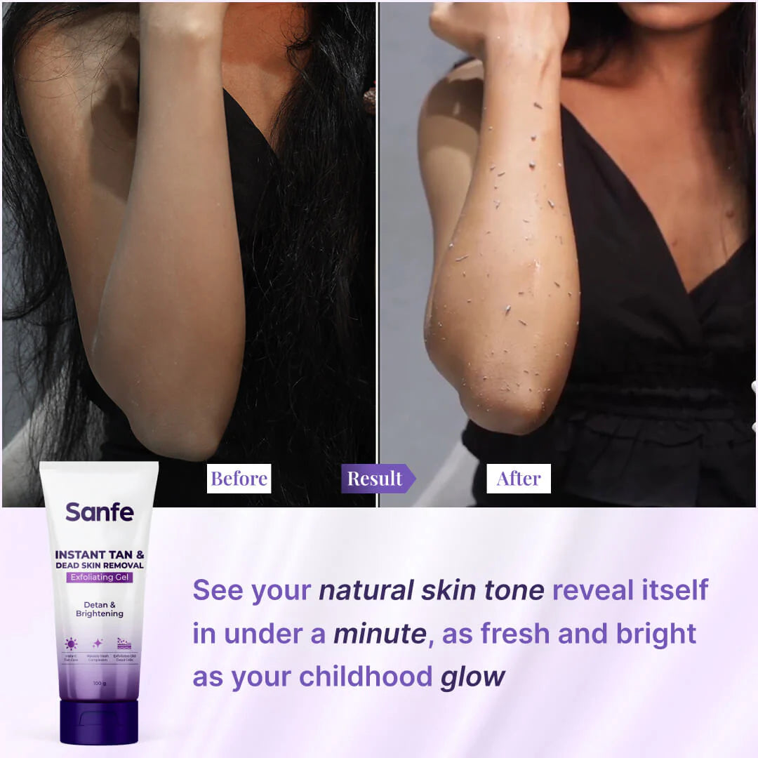 Sanfe Instant Tan & Dead Skin Removal Exfoliating Gel | Detan & Brightening Body Scrub